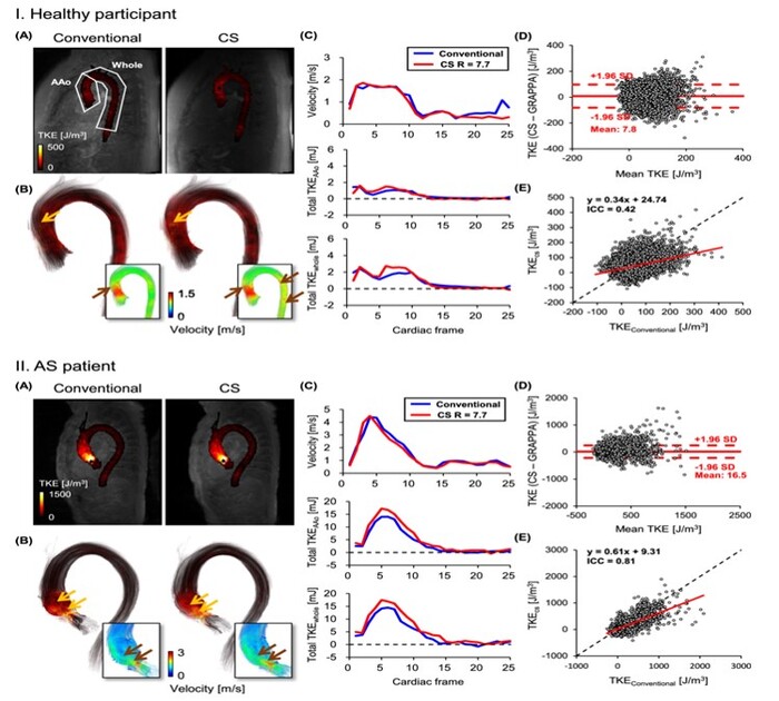한-미 심혈류 분석 공동연구, 검사시간 1/3 단축된 4D flow MRI 기술 개발